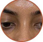 Oil SKin