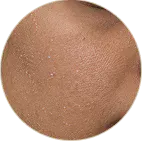 Dry SKin